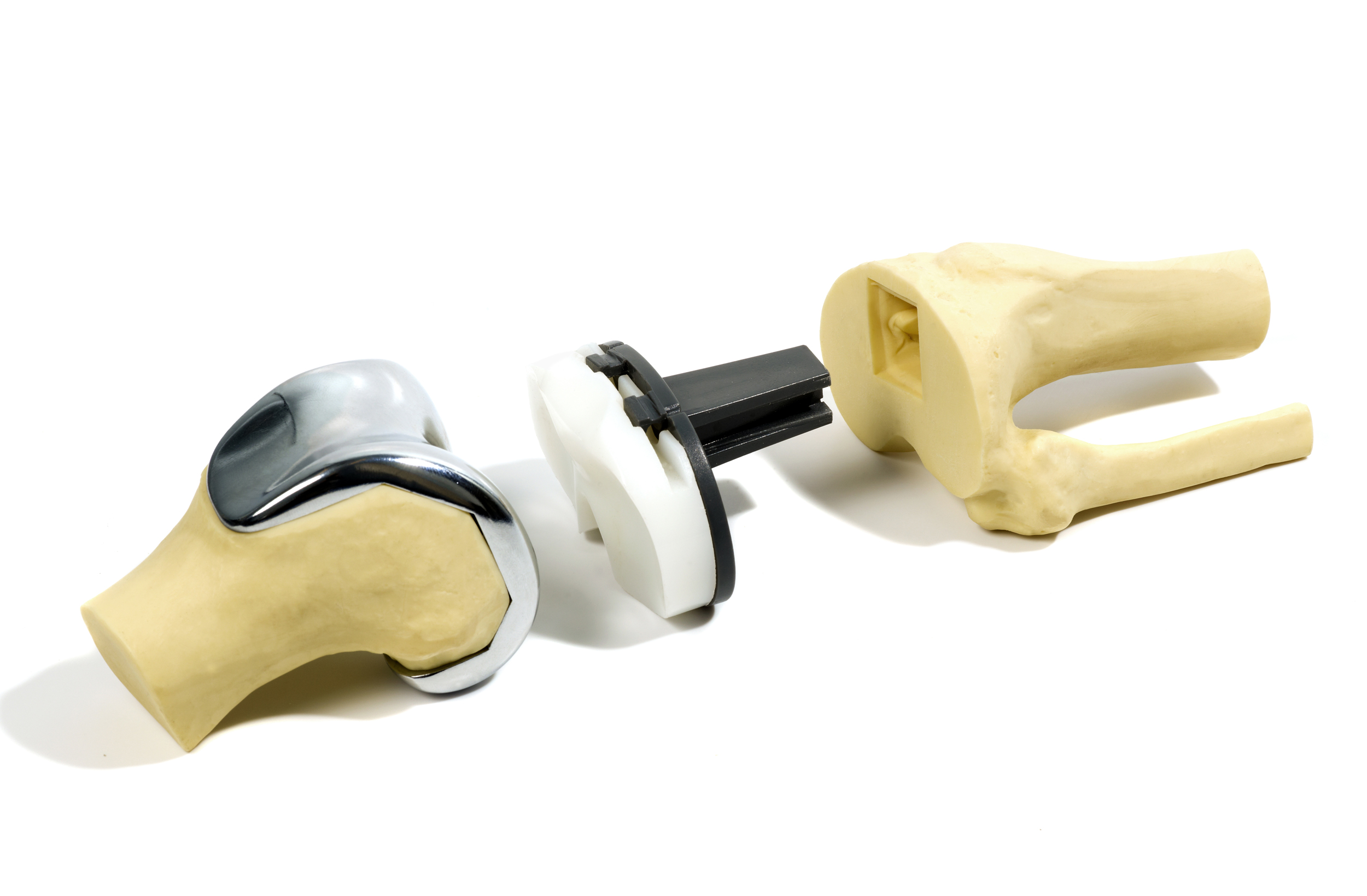 plastic model of a knee replacement